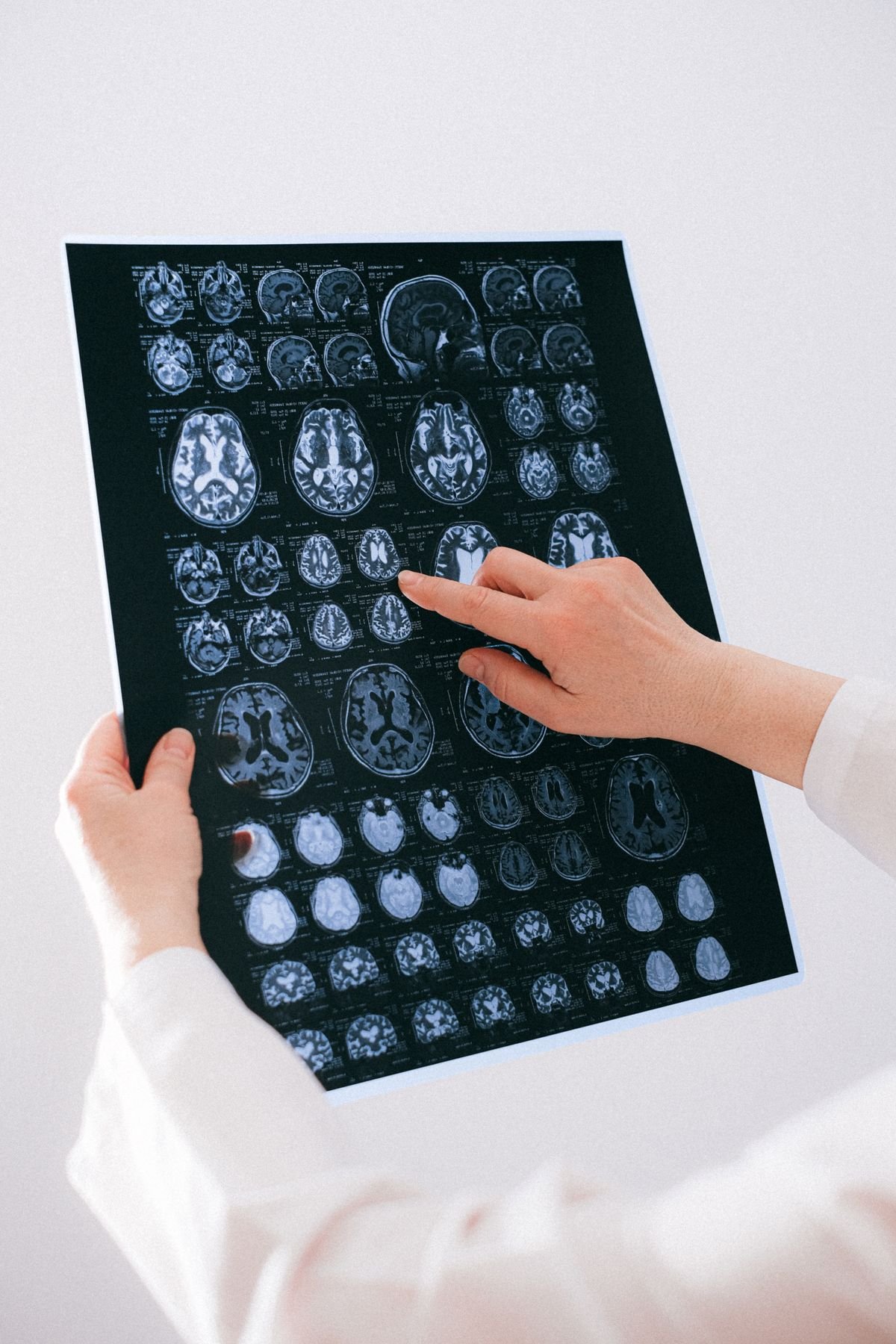 Hands holding a sheet of brain MRI imaging scans